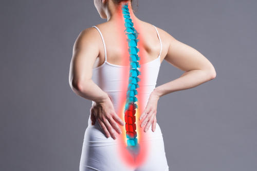 vertebral compression fractures, compression fractures, Osteoporotic Vertebral Compression fractures, Vertebral compression physical therapy center in Atlanta. 