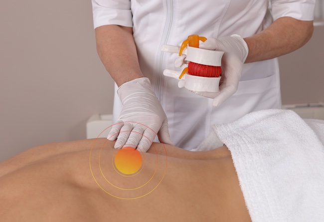 Disc Herniation Treatment