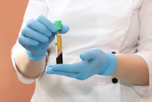 regenerative medicine, blood plasma for PRP therapy, platelet-rich plasma therapy