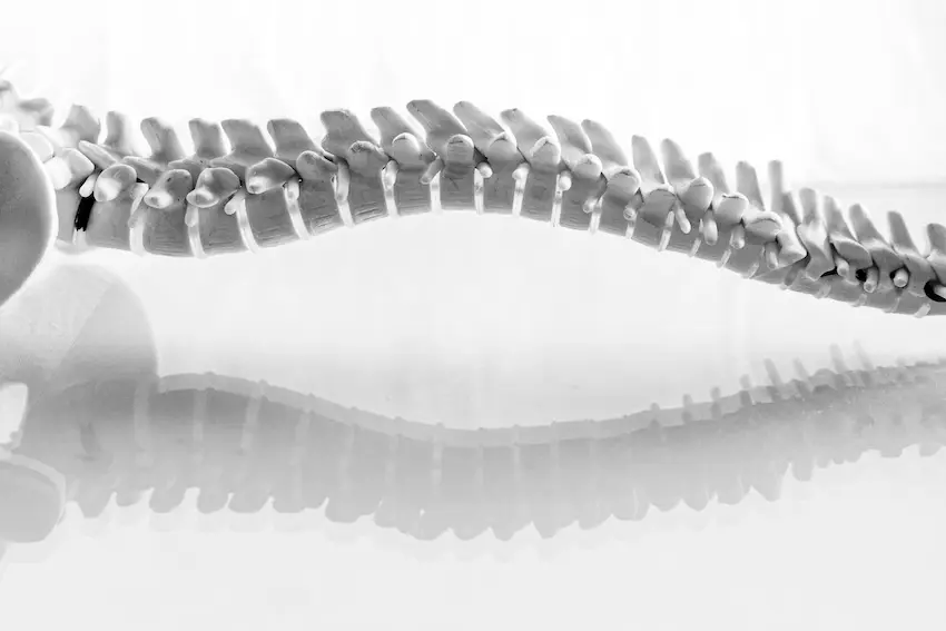 Physical therapist helping patient with functional limitation exercises at VeriSpine Joint Centers Atlanta
