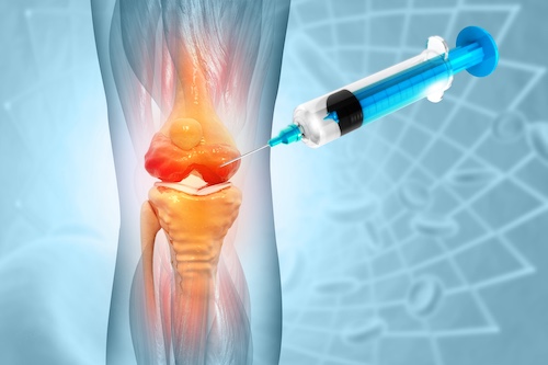 Stem Cell Therapy For Knee Pain Concept
