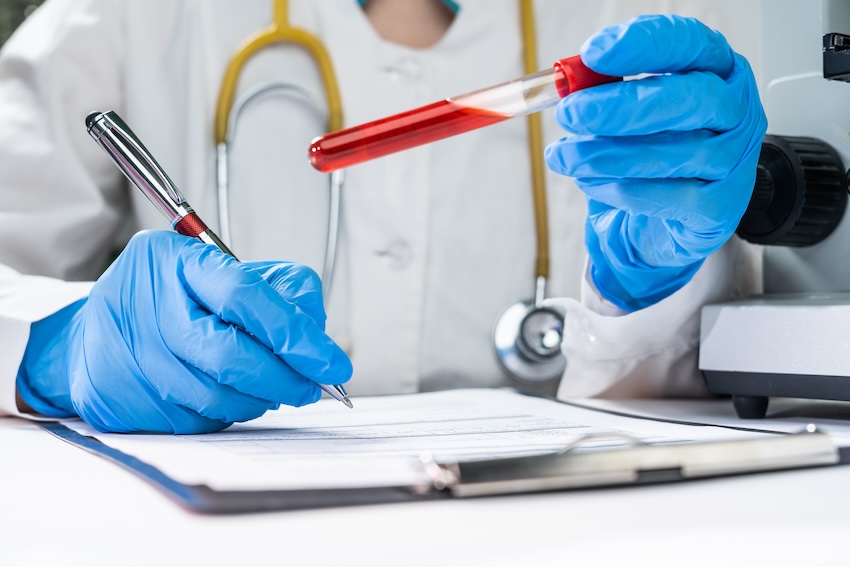 Medical laboratory centrifuge processing platelet-rich plasma for PRP therapy regenerative treatment